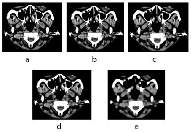 (a)  Hasil  pemrosesan  citra  asli,  (b)  citra  filter  R1,(c) citra filter R2, (d) citra filter R5, (e) citra filter R10.