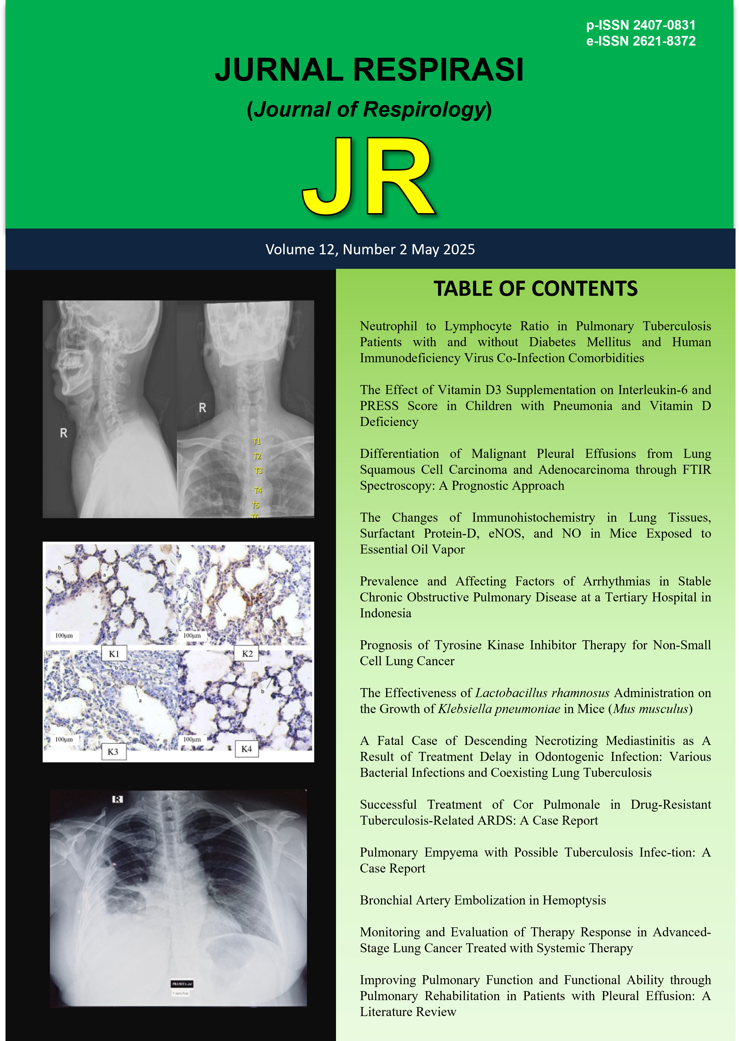 						View Vol. 11 No. 2 (2025): May 2025
					