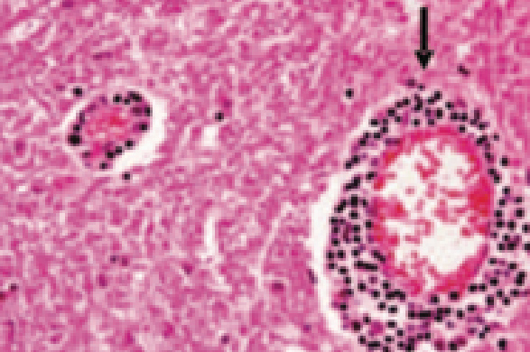 Perivascular cung in the cerebellum of a bualo (black arrow) (H.E staining at a 1000x magnication) (Beigh et al., 2017)